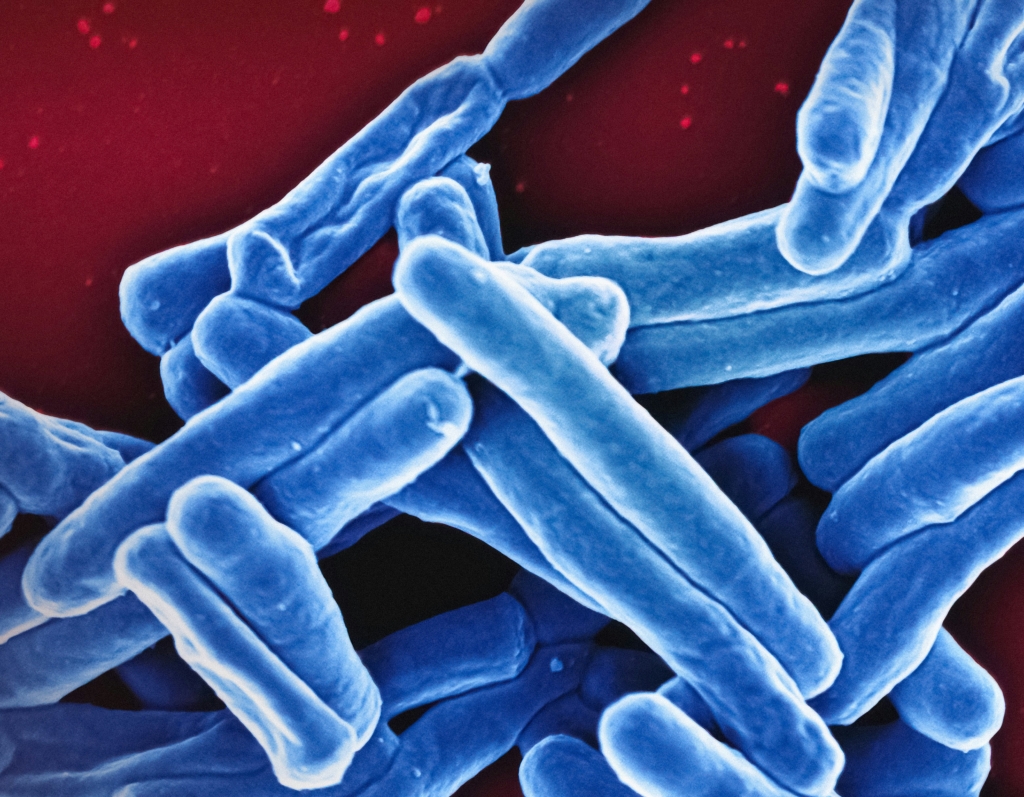 Tuberculosebacterie TBC